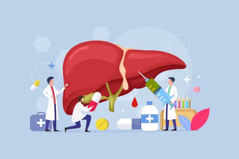 Keto Diet for Fatty Liver Disease