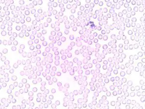 ketosis immune system