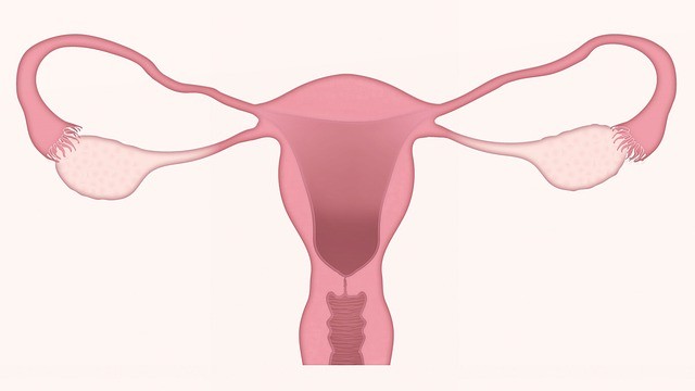 Keto PCOS Management: Is Keto Good For PCOS? Keto PCOS Management: Is Keto Good For PCOS?